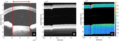 In-Vivo Measurement of Ocular Deformation in Response to Ambient Pressure Modulation